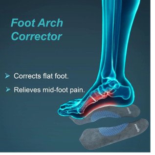 Tynor Medial Arch Orthosis K-11 - Pair | Relieves Flat Feet, Plantar Fasciitis, Arch Pain, Orthotic Support for Foot Alignment